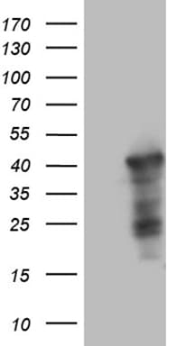 WDR92 Antibody (clone OTI1H8)