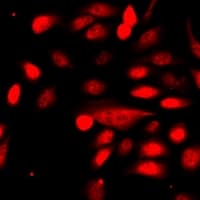 TRIM69 / Trif Antibody