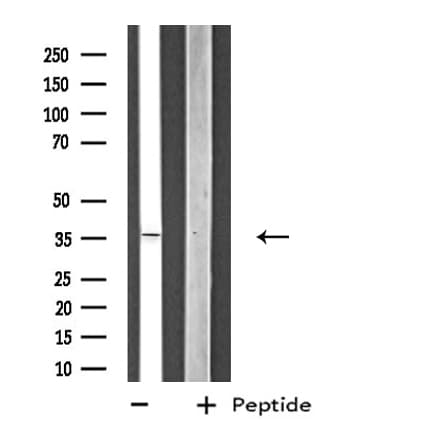 ZNF691 Antibody