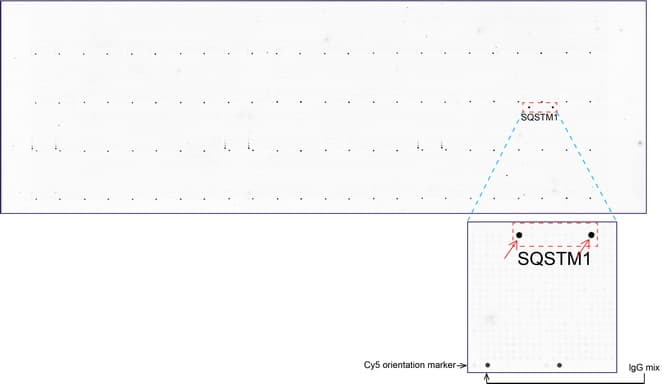 SQSTM1 Antibody (clone UMAB13, Carrier-free)