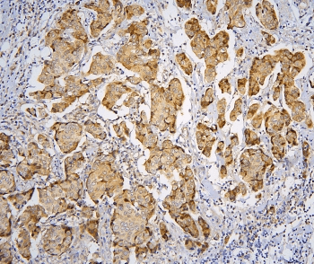 Polyclonal Rabbit anti-Human PPA1 Antibody (IHC, WB)