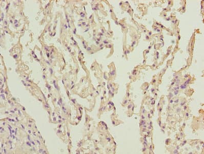 UBE2I / UBC9 Antibody
