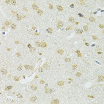 SLC37A4 / G6PT Antibody
