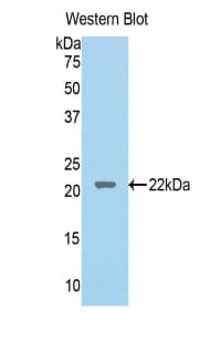 LCAT Antibody (aa41-210)