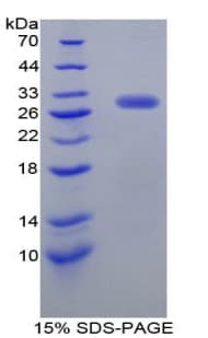 Rat DRD2 / Dopamine Receptor D2 Protein (Recombinant His-T7)