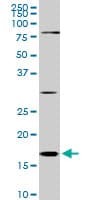 Monoclonal Mouse anti-Human CFL1 / Cofilin Antibody (clone 1A1, IHC, IF, WB)
