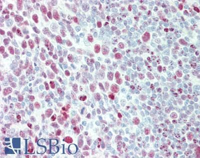 IHC-plus™ NCOR2 / SMRT Antibody (aa1525-1575)