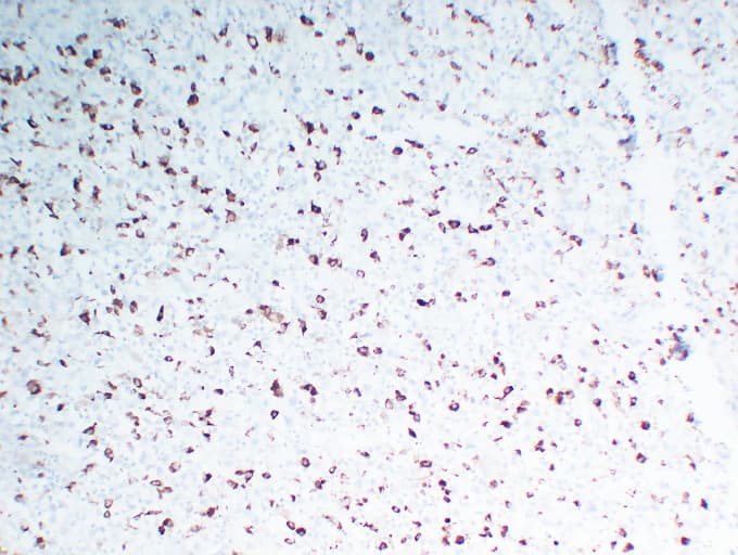 CD68 Antibody (clone ABT-CD68)