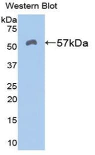 ALDH7A1 Antibody (aa29-539)