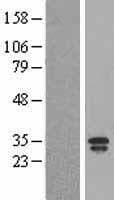 Human LCN2 / Lipocalin 2 / NGAL Protein (Over-Expression Lysate Myc-DDK (Flag))