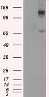 Monoclonal Mouse anti-Human L1CAM Antibody (clone OTI2C7, IHC, IF, WB)
