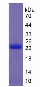 Cow IFNT2 / Interferon Tau Protein (Recombinant His, N-Terminal)