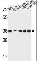 TOR1B / Torsin B Antibody (aa210-237)