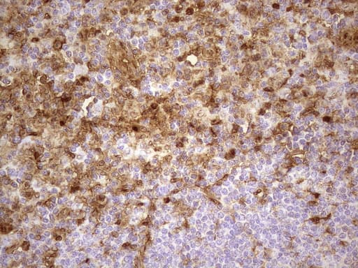 LGALS3 / Galectin 3 Antibody (clone UMAB189)