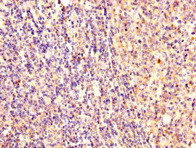 EZR / Ezrin Antibody