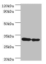 PNP / Nucleoside Phosphorylase Antibody (aa1-289)
