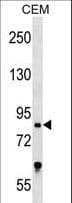 TCF25 Antibody (aa186-215)