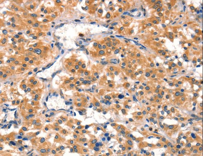 AIMP1 / EMAP II Antibody
