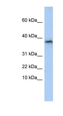 Polyclonal Rabbit anti-Human GLYAT Antibody (aa71-120, WB)
