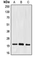 EFNA2 / Ephrin A2 Antibody (C-Terminus)