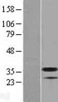 TM2D3 Protein (Over-Expression Lysate Myc-DDK (Flag))