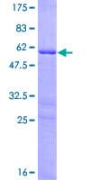 Human HOXB9 Protein (Recombinant GST)