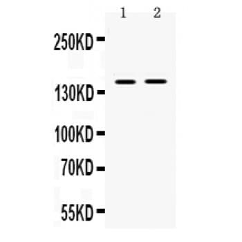 TRIM33 / TIF1-Gamma Antibody (aa1001-1127)