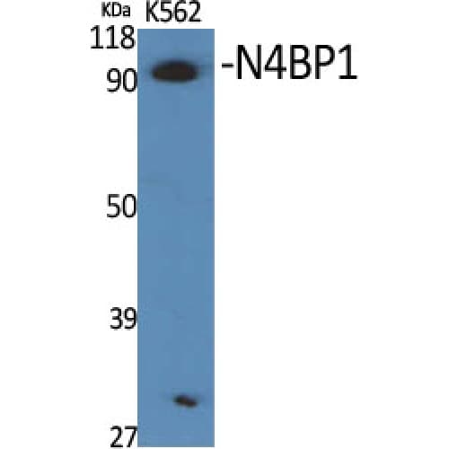 Polyclonal Rabbit anti-Human N4BP1 Antibody (360-440 aa, Internal, IHC, WB)
