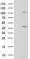 PRKAR1B Antibody (clone OTI2A3)
