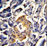 SRP72 Antibody (aa119-148)