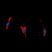 Polyclonal Rabbit anti-Human ADGRB1 / BAI1 Antibody (Internal, IF, WB)