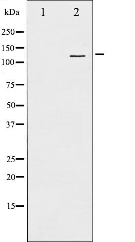 GRIN1 / NMDAR1 Antibody (phospho-Ser897)