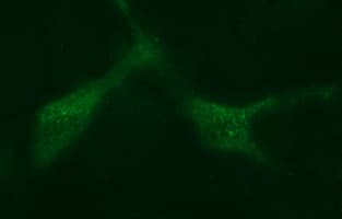 MAdCAM-1 Antibody (clone OTI2A7)