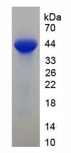 Mouse FABP3 / H-FABP Protein (Recombinant His-GST)