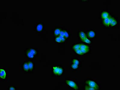 Polyclonal Rabbit anti-Human AK5 / Adenylate Kinase 5 Antibody (IHC, IF, WB)