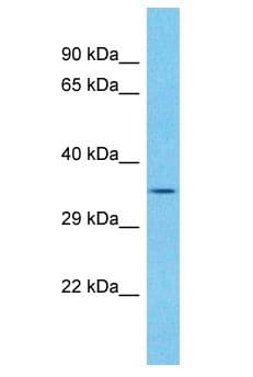 Polyclonal Rabbit anti-Human SFR1 / C10orf78 Antibody (aa102-151, WB)