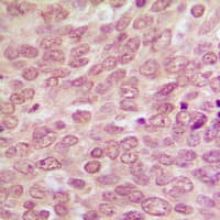 Polyclonal Rabbit anti-Human TP53 / p53 Antibody (N-Terminus, IHC, IF, WB)