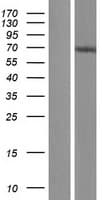NOP9 Protein (Over-Expression Lysate Myc-DDK (Flag))