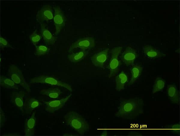 HNF4A / HNF4 Antibody (clone 4E2)