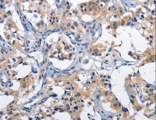 CLEC2D / OCIL / LLT1 Antibody