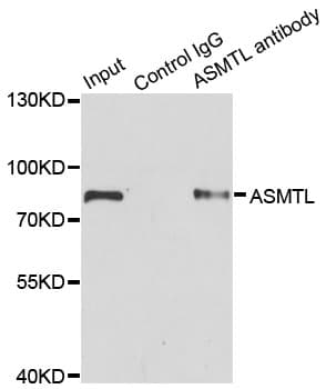 Polyclonal Rabbit anti-Human ASMTL Antibody (IHC, WB)