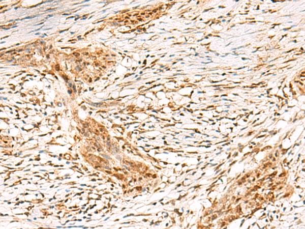 DCAF10 Antibody
