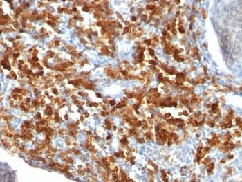 CD79A / CD79 Alpha Antibody (clone IGA/515)