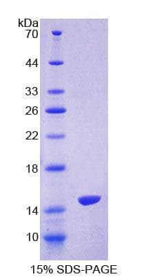 Human S100Z Protein (Recombinant His-T7, N-terminus)