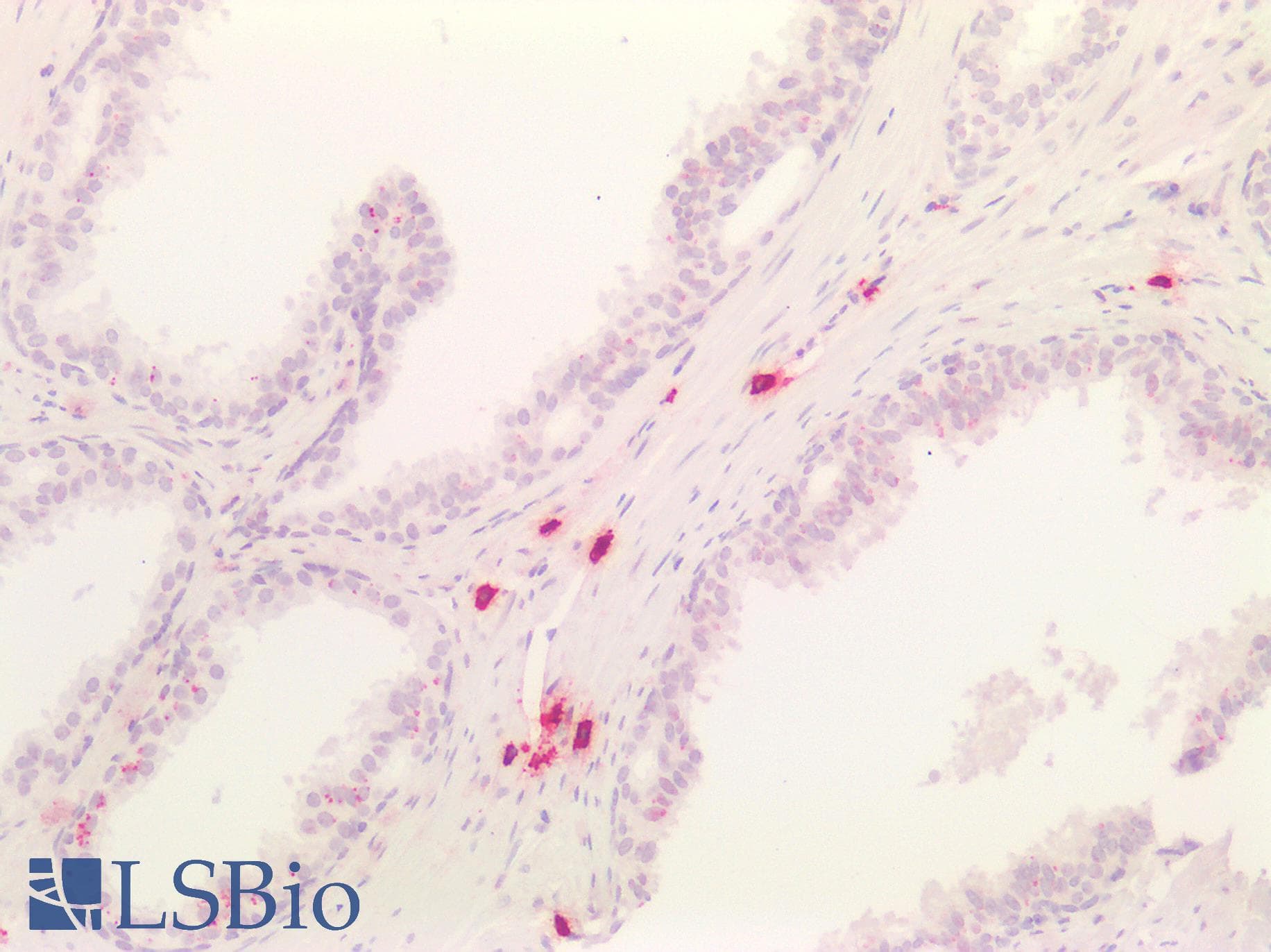 PathPlus™ Monoclonal Mouse anti-Human CMA1 / Mast Cell Chymase Antibody (IHC, WB)