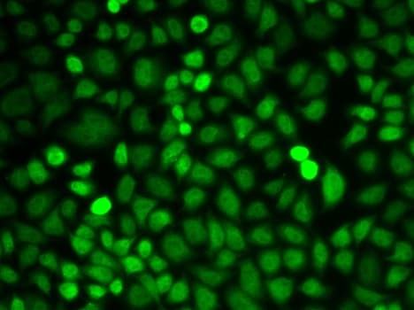 IHC-plus™ Polyclonal Rabbit anti-Human HNRNP-E2 / PCBP2 Antibody (IHC, IF, WB)