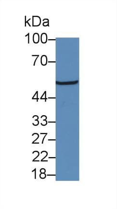 NR3C1/Glucocorticoid Receptor Antibody (aa41-184, Biotin)