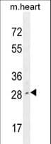 LIX1 Antibody (aa221-250)