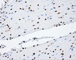 TLDC1 / KIAA1609 Antibody (clone OTI12B1)