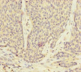 Polyclonal Rabbit anti-Human UACA Antibody (IHC, WB)
